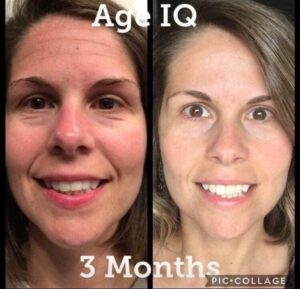 neora age iq before and after lisa michelle